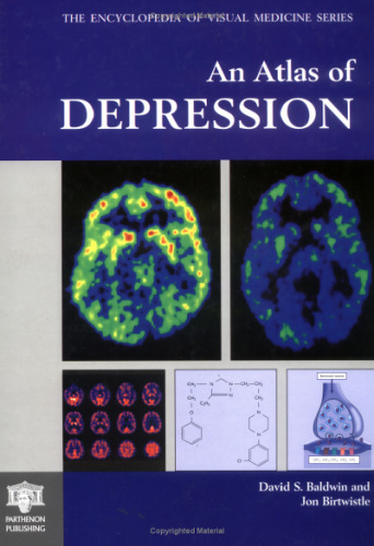An atlas of depression