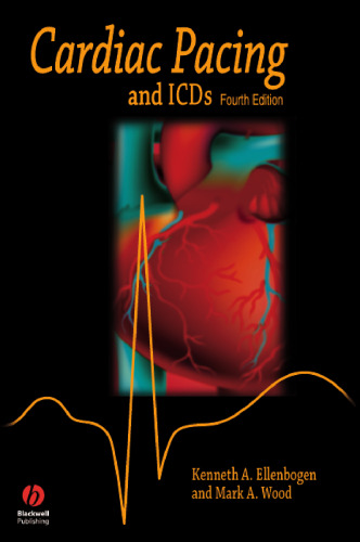 Cardiac pacing and ICDs