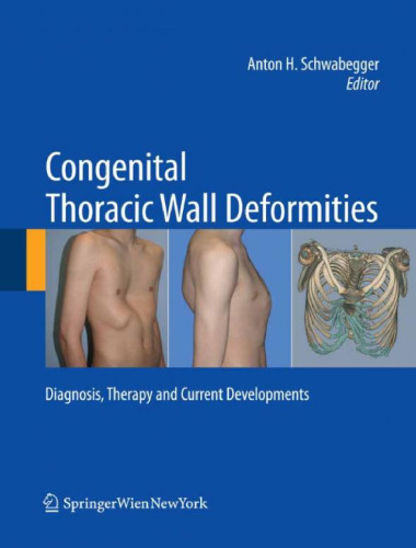 Congenital thoracic wall deformities : diagnosis, therapy, and current developments
