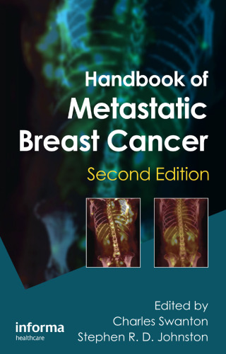 Handbook of metastatic breast cancer