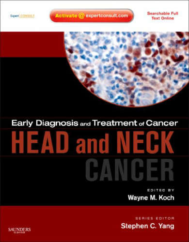 Head and neck cancer