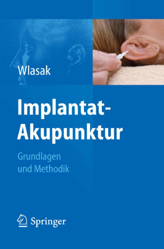 Implantat-Akupunktur: Grundlagen und Methodik