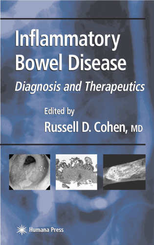 Inflammatory bowel disease : diagnosis and therapeutics