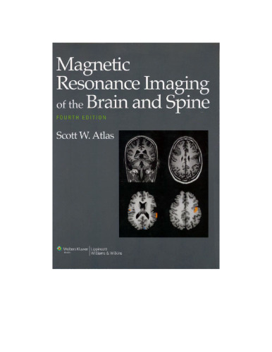 Magnetic resonance imaging of the brain and spine. 2