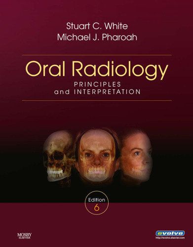 Oral radiology : principles and interpretation