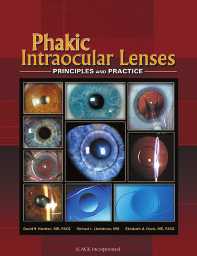 Phakic intraocular lenses : principles and practice