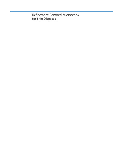 Reflectance Confocal Microscopy for Skin Diseases