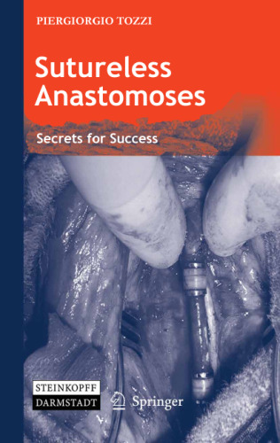 Sutureless anastomoses : secrets for success