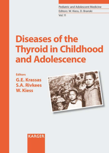 Diseases of the thyroid in childhood and adolescence