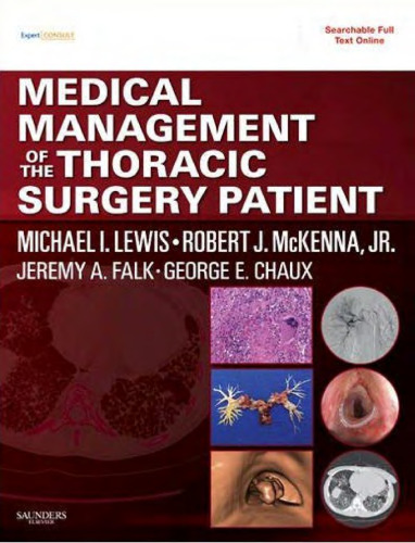 Medical management of the thoracic surgery patient