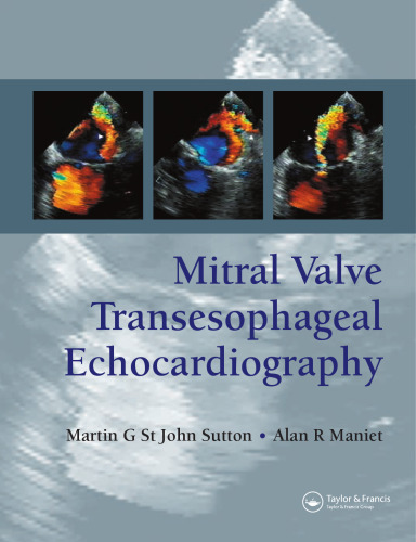 Mitral valve transesophageal echocardiography