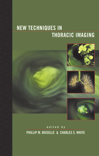 New techniques in thoracic imaging