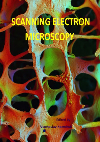 Scanning Electron Microscopy