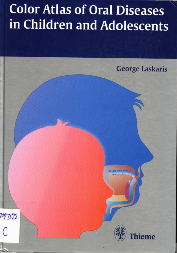 Color atlas of oral diseases in children and adolescents