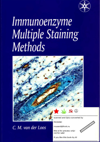 Immunoenzyme multiple staining methods