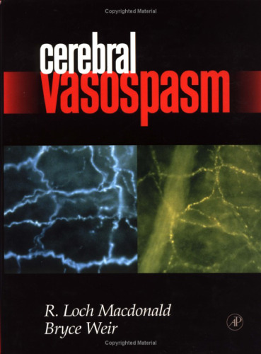 Cerebral vasospasm