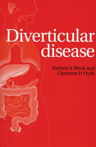 Diverticular disease