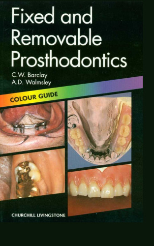 Fixed and removable prosthodontics : color guida