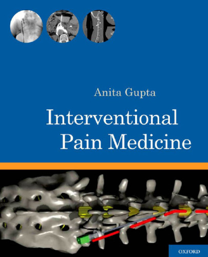 Interventional pain medicine