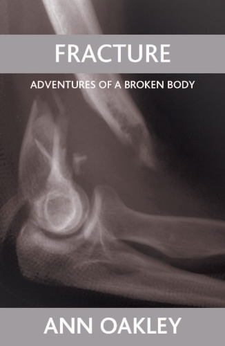 Fracture : adventures of a broken body