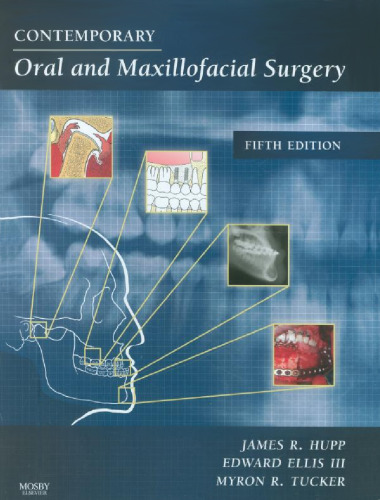 Contemporary Oral and Maxillofacial Surgery, 5e