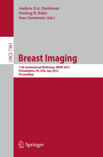 Breast Imaging: 11th International Workshop, IWDM 2012, Philadelphia, PA, USA, July 8-11, 2012. Proceedings