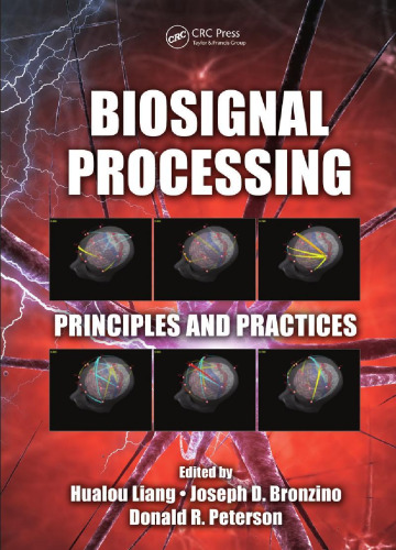 Biosignal Processing: Principles and Practices