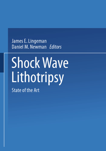 Shock Wave Lithotripsy: State of the Art