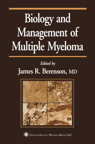 Biology and Management of Multiple Myeloma