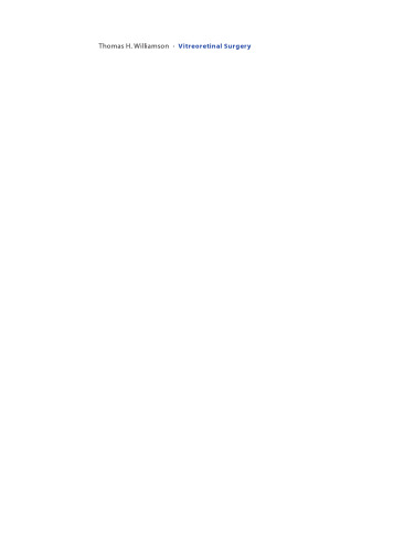 Vitreoretinal Surgery