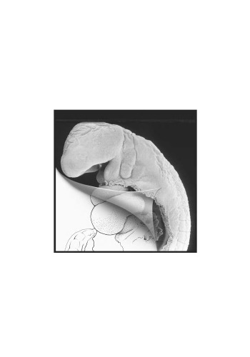 Steding’s and Viragh’s Scanning Electron Microscopy Atlas of the Developing Human Heart