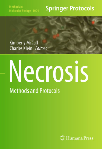 Necrosis: Methods and Protocols