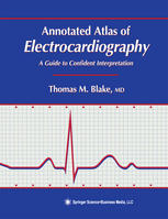 Annotated Atlas of Electrocardiography: A Guide to Confident Interpretation
