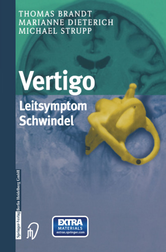 Vertigo: Leitsymptom Schwindel