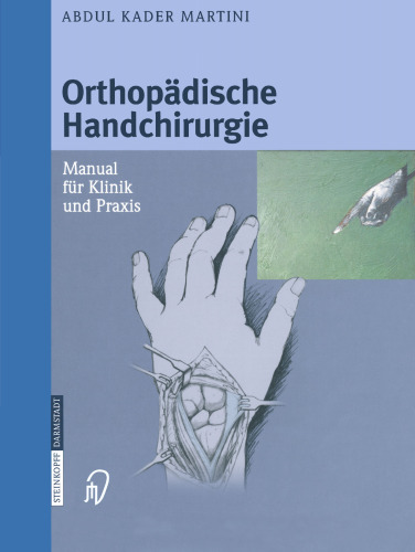 Orthopadische Handchirurgie: Manual fur Klinik und Praxis