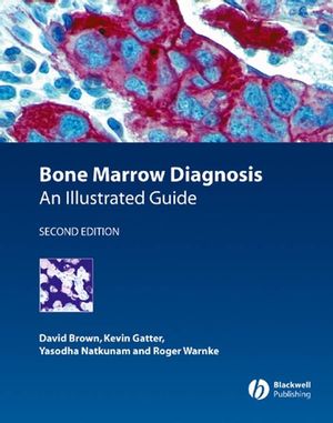 Bone Marrow Diagnosis: An Illustrated Guide, Second Edition