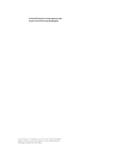 Critical Decisions in Emergency and Acute Care Electrocardiography